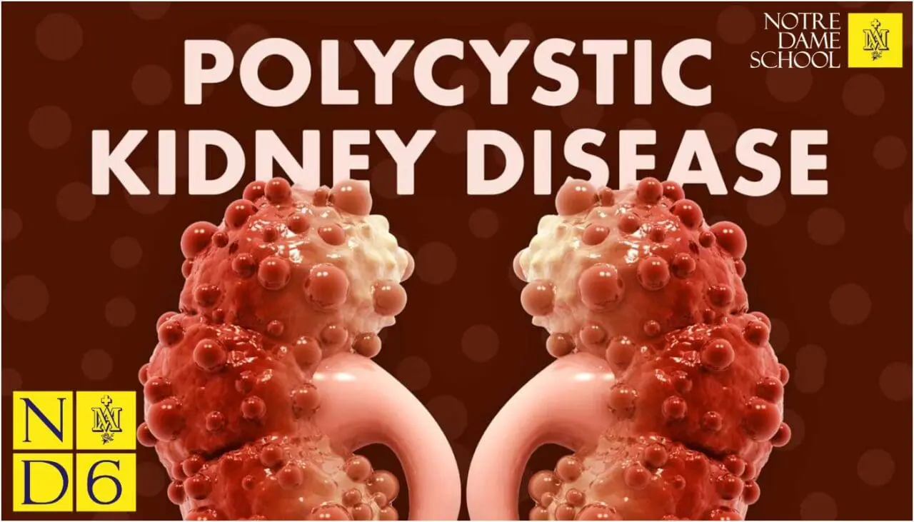 Science Corner - Polycystic Kidney Disease Treatment