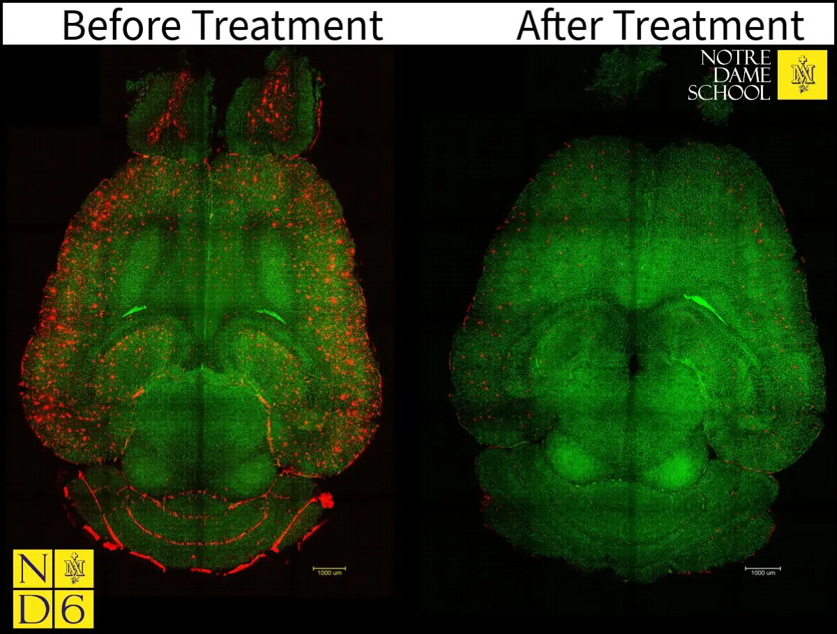 Reversing Alzheimer's in Mice