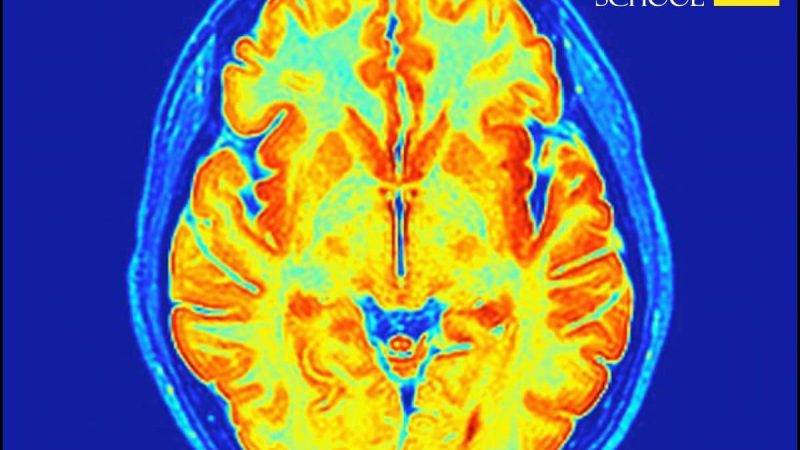 Science Corner - Baby Brain