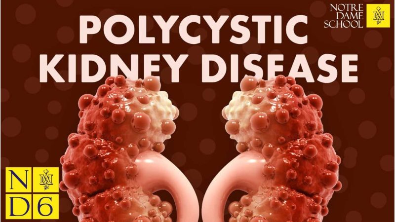 Science Corner - Polycystic Kidney Disease Treatment