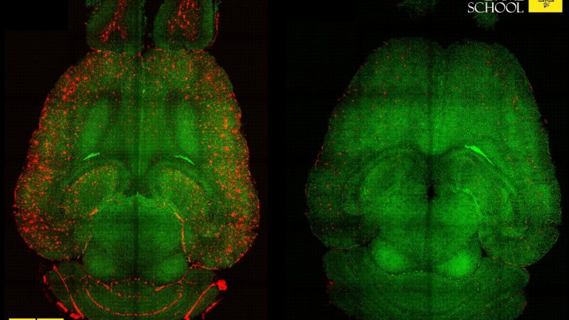 Reversing Alzheimer's in Mice
