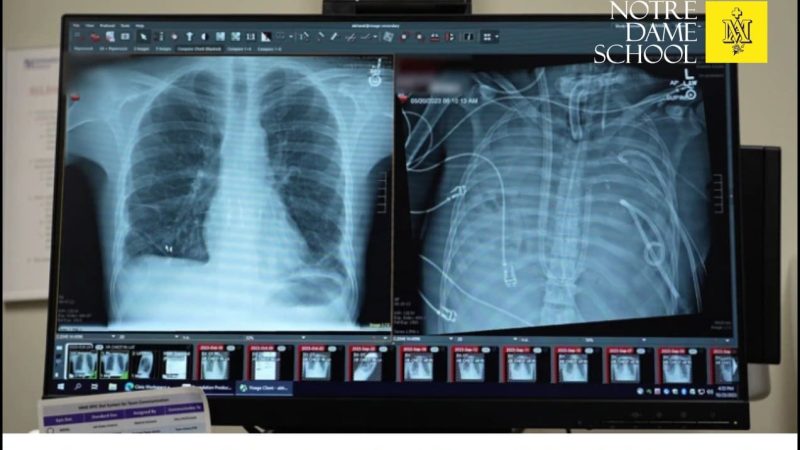 Senior Science Corner - XRays of Lungs